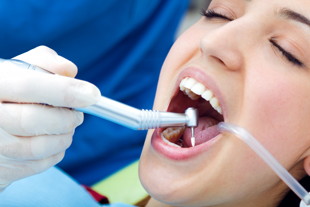 Everything You Need To Know About Dental Implants And How Long They Last