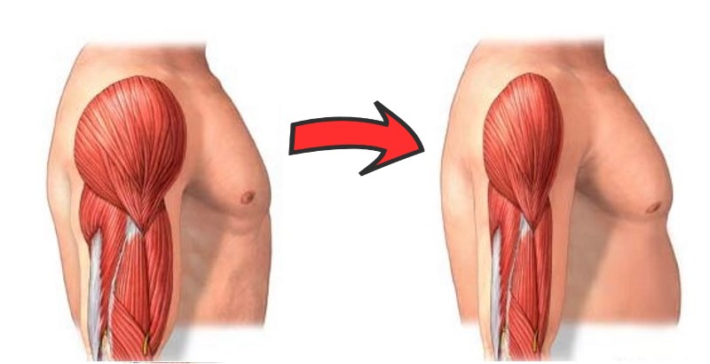Global Sarcopenia Treatment Market 2021 - Top Key Players Analysis Report Till 2027