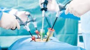 Hand-Held Surgical Instruments Market Size, In-depth Analysis Report and Global Forecast to 2027