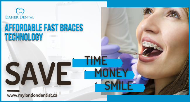Do you want an inexpensive and fast option to straighten your teeth?