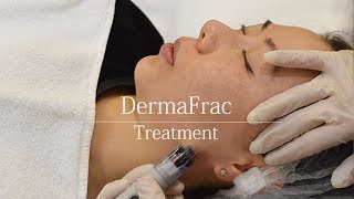 DERMAFRAC MICRONEEDLING TREATMENT IN DELHI / MUMBAI / GURGAON