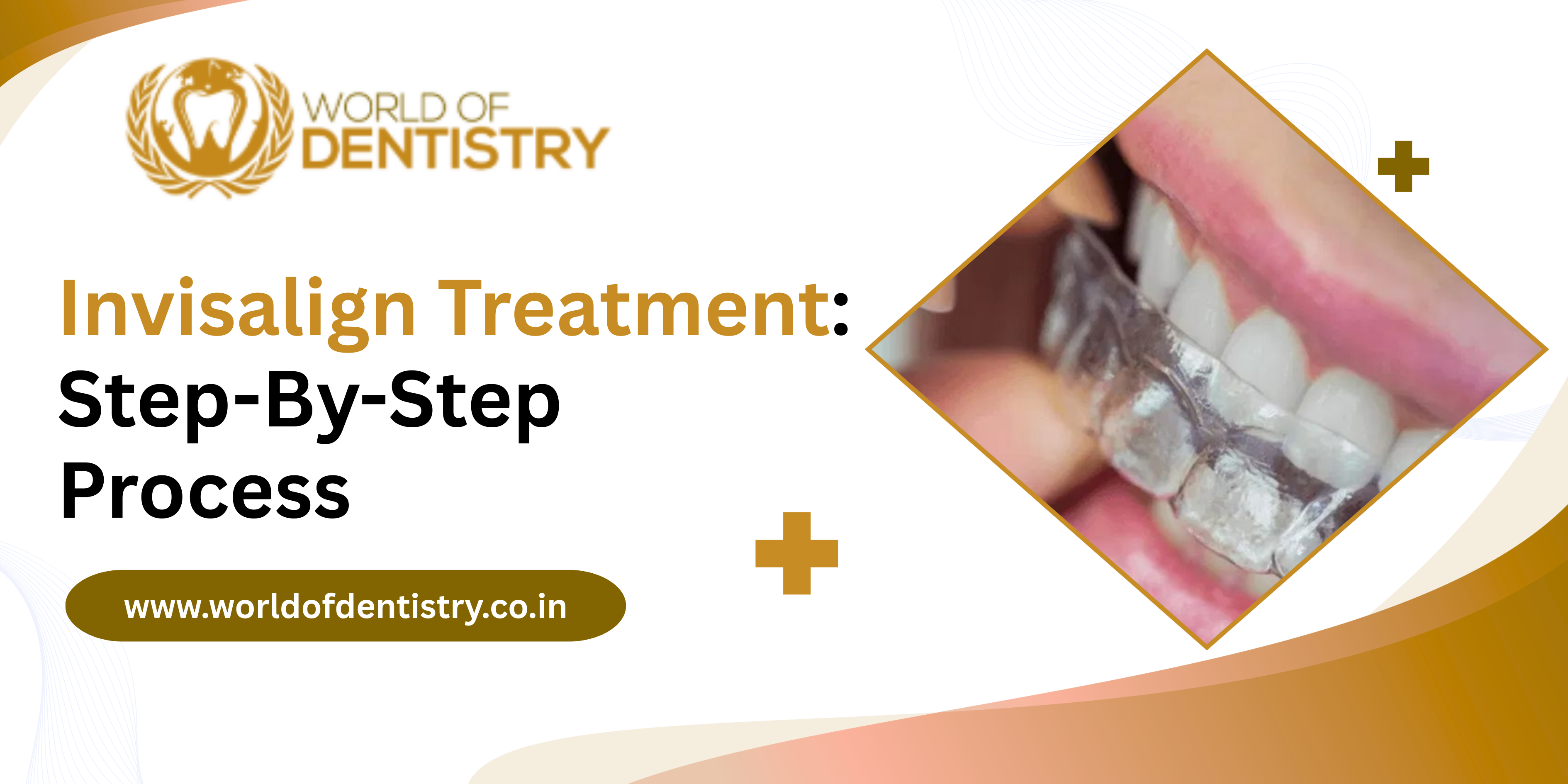Complete Guide to Invisalign Treatment: Step-By-Step Process