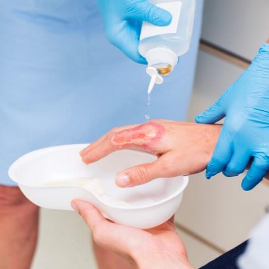 Wound Cleanser Products Market Analysis Report and Opportunities Upto 2028