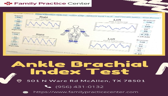 Ankle Brachial Index Test