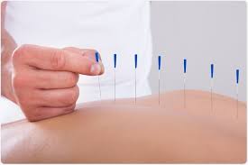 How Acupuncture Can Help With Infertilty