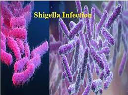 Global Shigella Infection Treatment Market Report, Latest Trends, Industry Opportunity & Forecast to 2027
