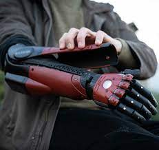 Global Prosthetic Arm Market Report, Latest Trends, Industry Opportunity & Forecast to 2027
