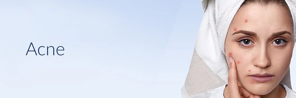 Acne and Acne Scar Treatment