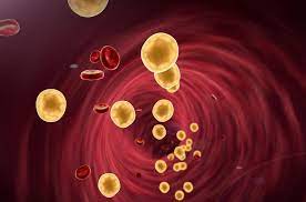 Lipid Disorder Treatment Market 2021 Major Key Players and Industry Analysis Till 2027