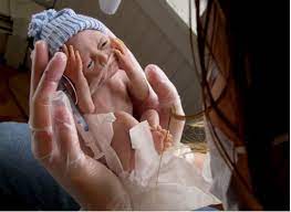 Preterm Birth And PROM Testing Market Size, Share, Growth, Opportunities and Global Forecast to 2027