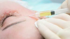 Is Microneedling with PRP Right for Hyperpigmentation?