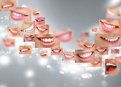 Dental Implant Cost in Dubai