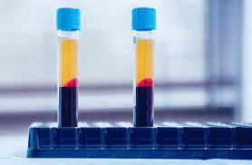 Platelet Rich Plasma Market Size, Drivers, Restraints Challenges, and Growth Opportunities Till 2027
