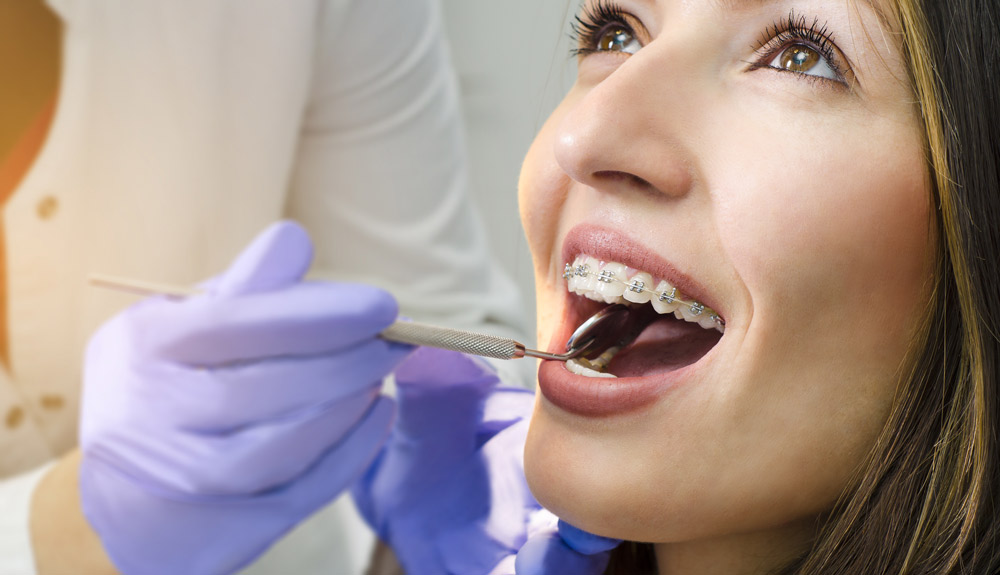 Are you a good candidate for invisalign?