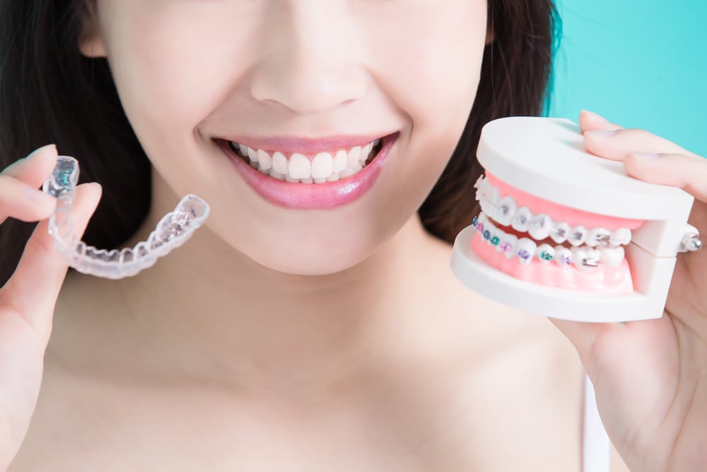 Advantages Of Using Invisalign