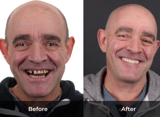 Oral Surgeon Wollongong