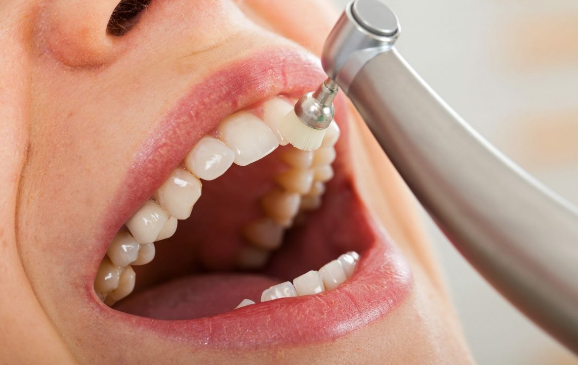 How to Make Your Dental Cleaning Last Longer