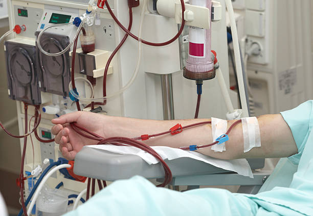 Kidney Dialysis Centers Email Lists | EKidney Dialysis Centers Database