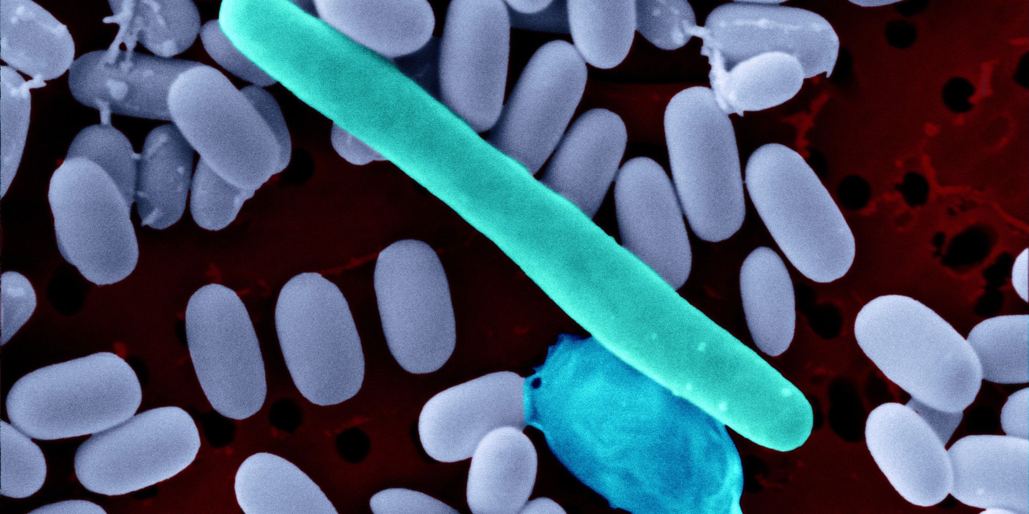 From Lab to Life-Saver: The Story of Clostridium Vaccine Research