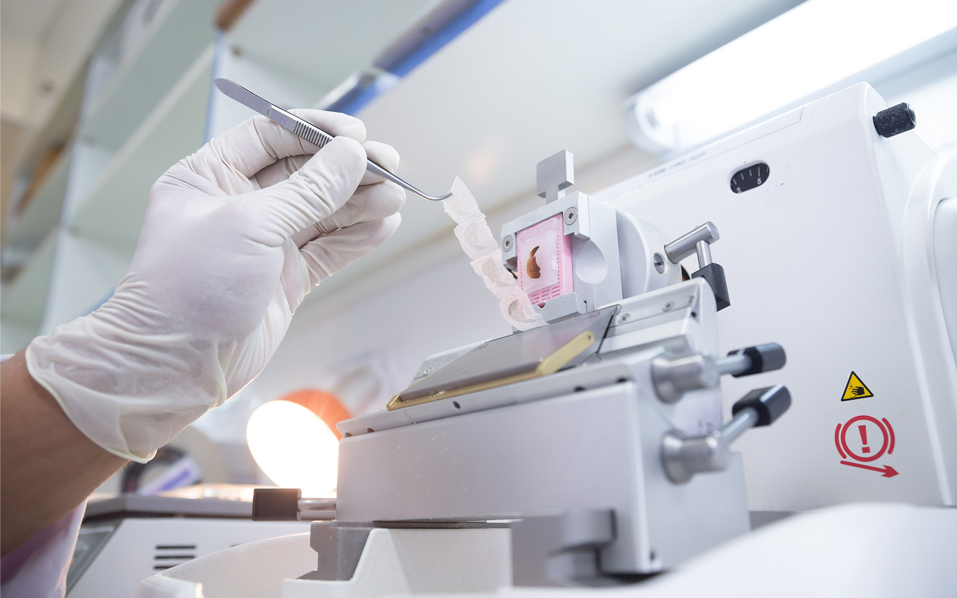 Anatomic Pathology Market is Estimated to Witness High Growth Owing to the Rising Prevalence of Chronic Diseases