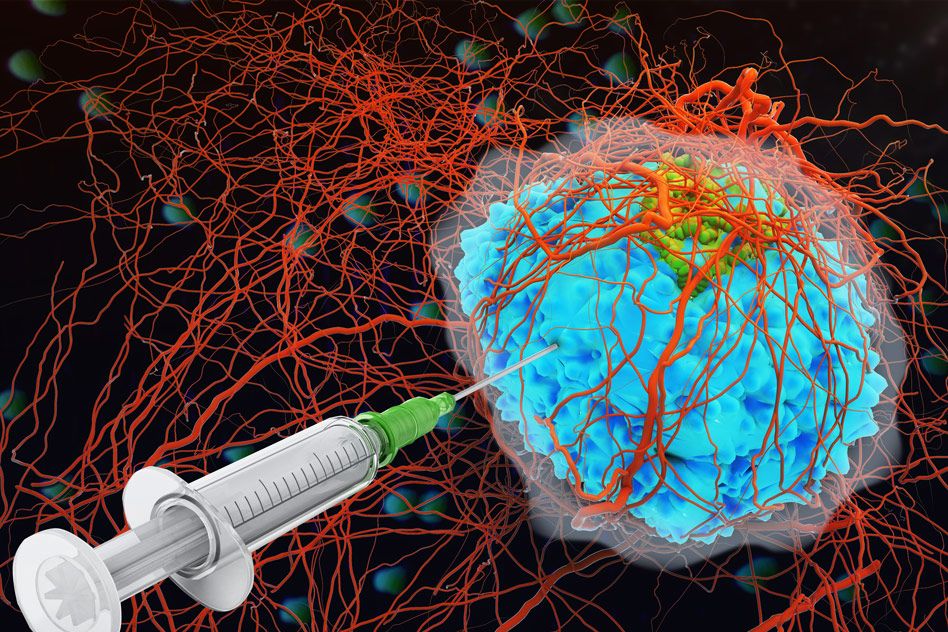 Peripheral Neuropathy Treatment Market Propelled By Rising Prevalence Of Diabetes Peripheral Neuropathy