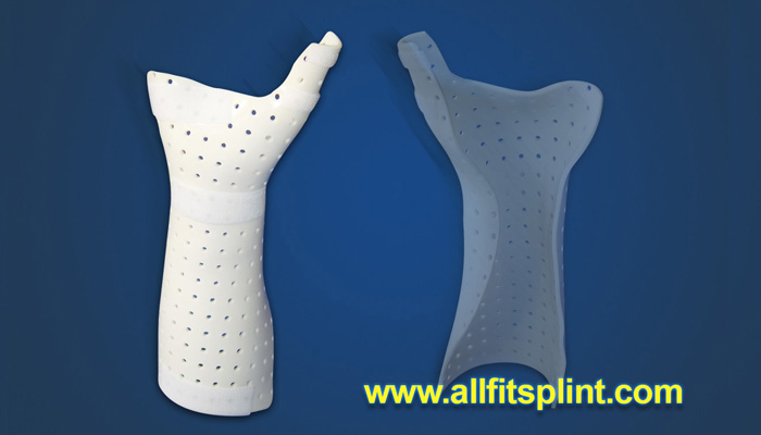 How Thermoplastic Splints Have Changed the Way We Do Orthopaedics
