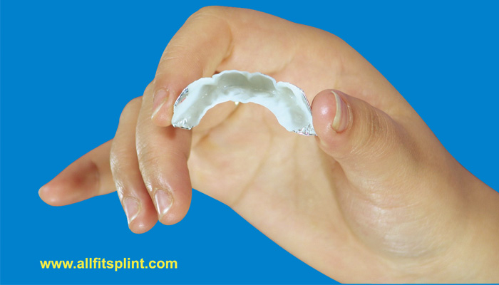 The Use of AllFit Dental Casts in Incisional