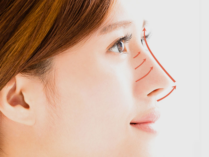 Rhinoplasty Surgery In Lahore | Nose Reshaping In Lahore