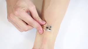 Monitoring Patches Market Report 2021 | Global Industry Trends, Forecasts and Opportunity Assessment Till 2026