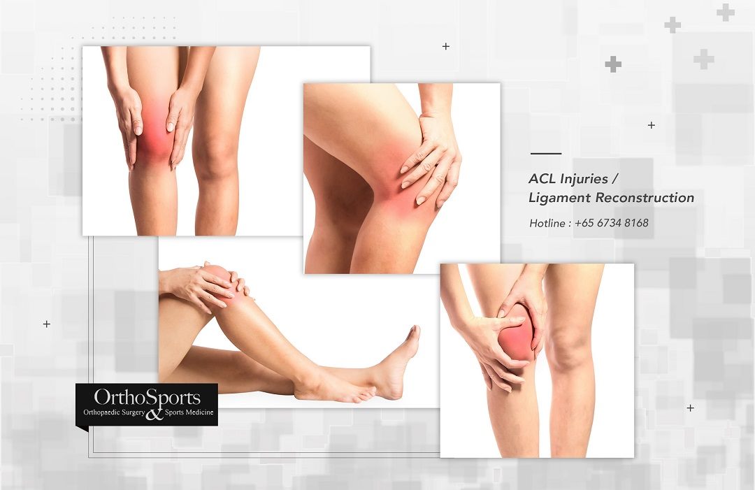 Techniques to Deal With a Ligament Tear in Singapore