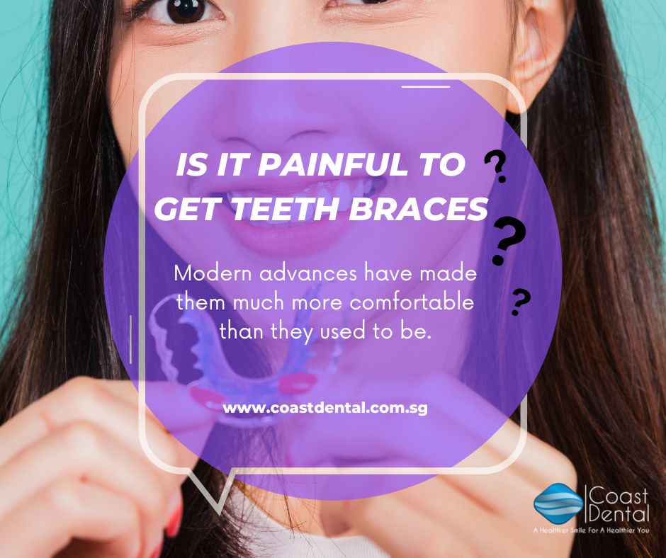Teeth Braces Singapore - Coast Dental