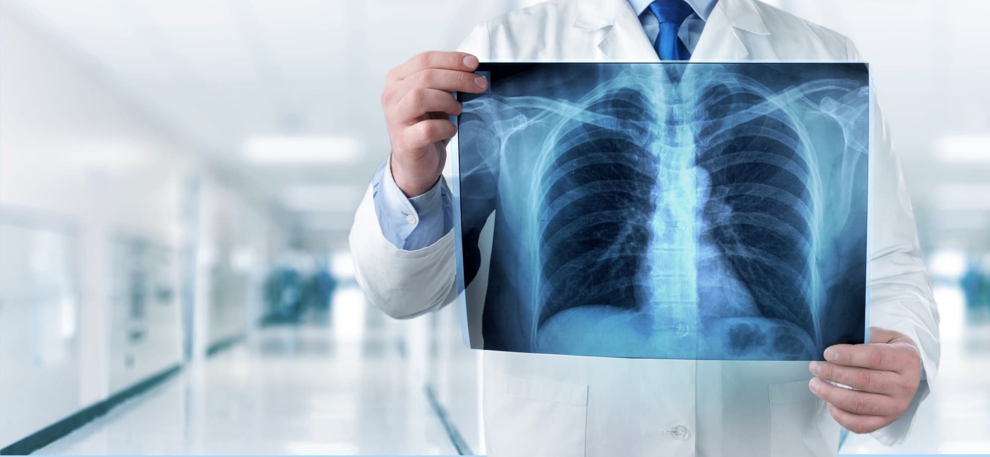 X-ray Market Ramp Up for Global Hike - New Business Opportunities for Investors