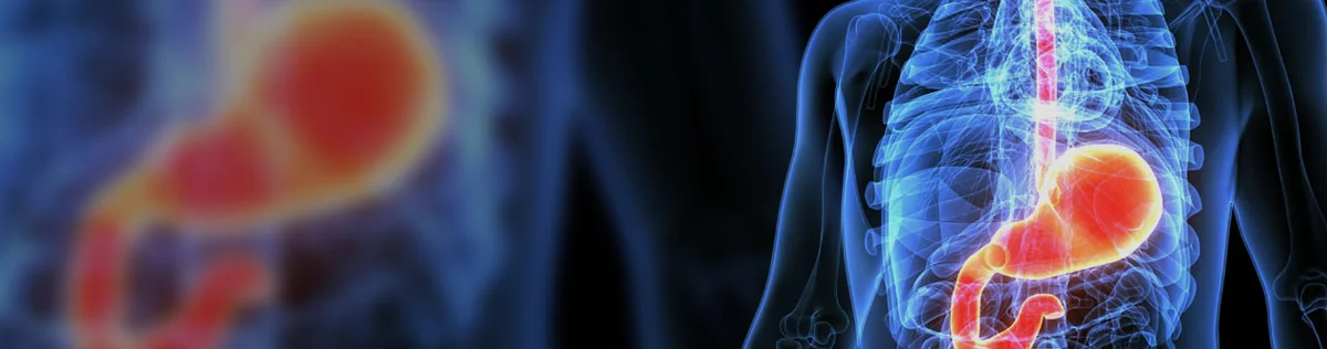 How to Treat and Diagnose Stomach Cancer in Singapore