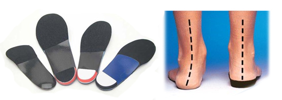 Custom Orthotics