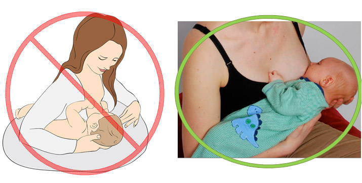 What Is “Mommy Thumb” (also known as DeQuervain’s Syndrome)?