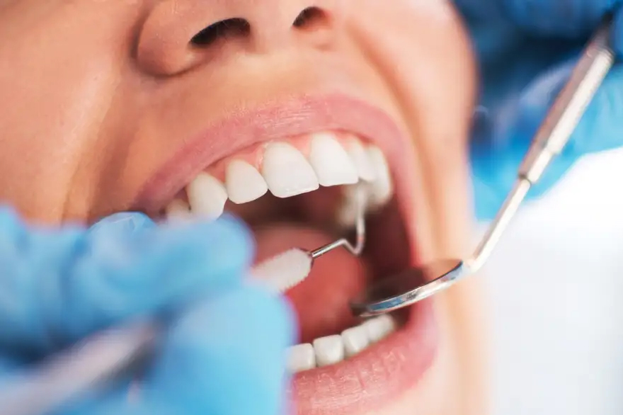 Best Dental Clinic in Abu Dhabi