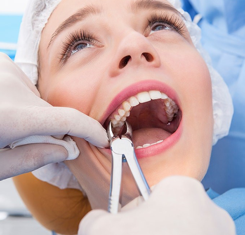 Tooth Extraction and Removal Services In Chandigarh - Pooran Dental Clinic