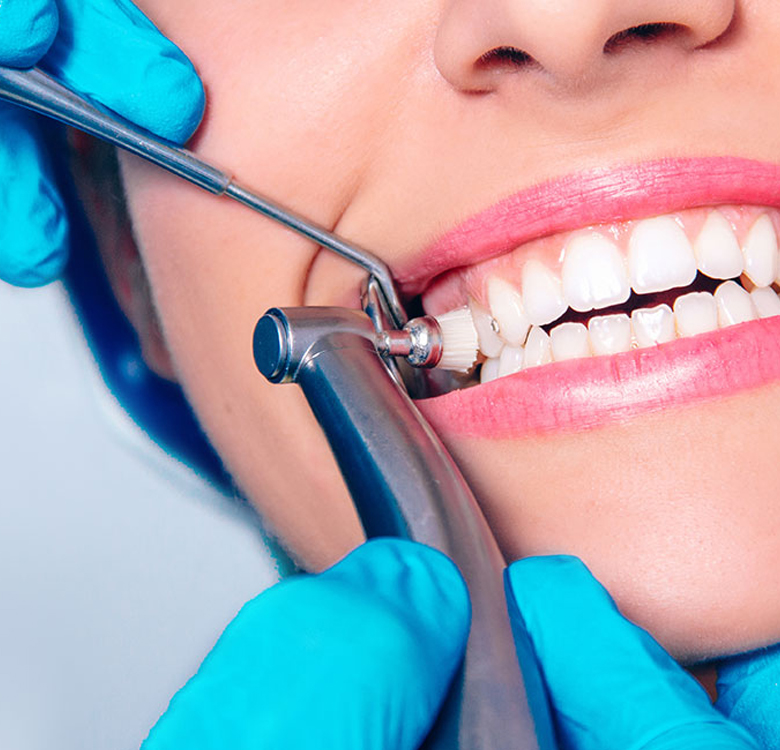 Best Teeth Cleaning Dentist in Chandigarh - Pooran Dental Clinic