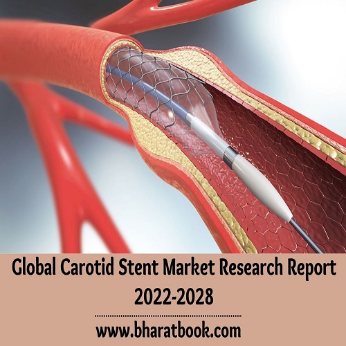 Global Carotid Stent Market Size Study, By type, By Application and Regional Forecast to 2022-2028
