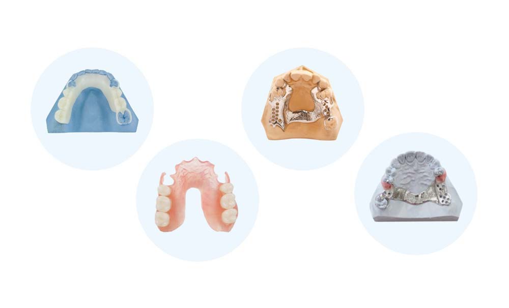 Different Types of Partial Dentures
