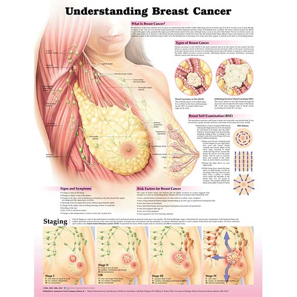 Health: Breast cancer