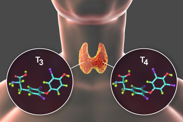 Hashimoto Treatment That Makes A Difference