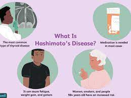 Are You Looking For The Best Hashimotos Disease Diet?