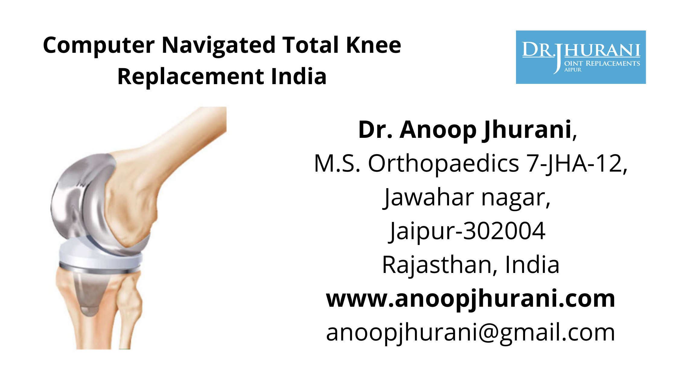 Computer Navigated Total Knee Replacement India Dr. Anoop Jhurani