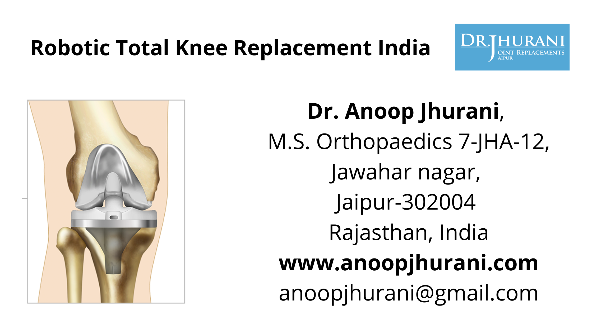 Robotic Total Knee Replacement India Dr. Anoop Jhurani