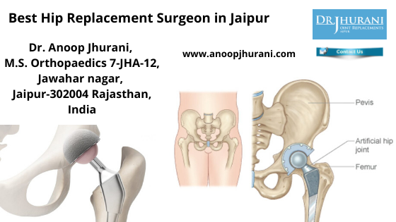 Best Hip Replacement Surgeon in Jaipur Top Surgeons in Jaipur