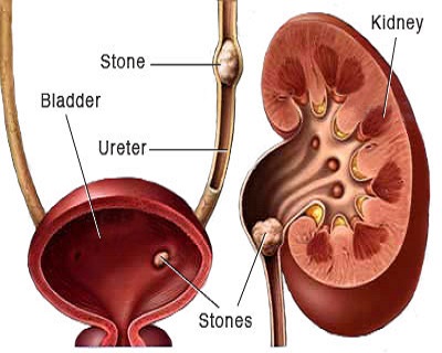 Dr. Amol Talaulikar | Kidney specialist in Pune.
