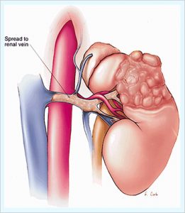 Best Urological Surgeon in Pune | Dr. Abhijit Gokhale