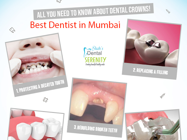 Best Dental Surgeons in South Mumbai