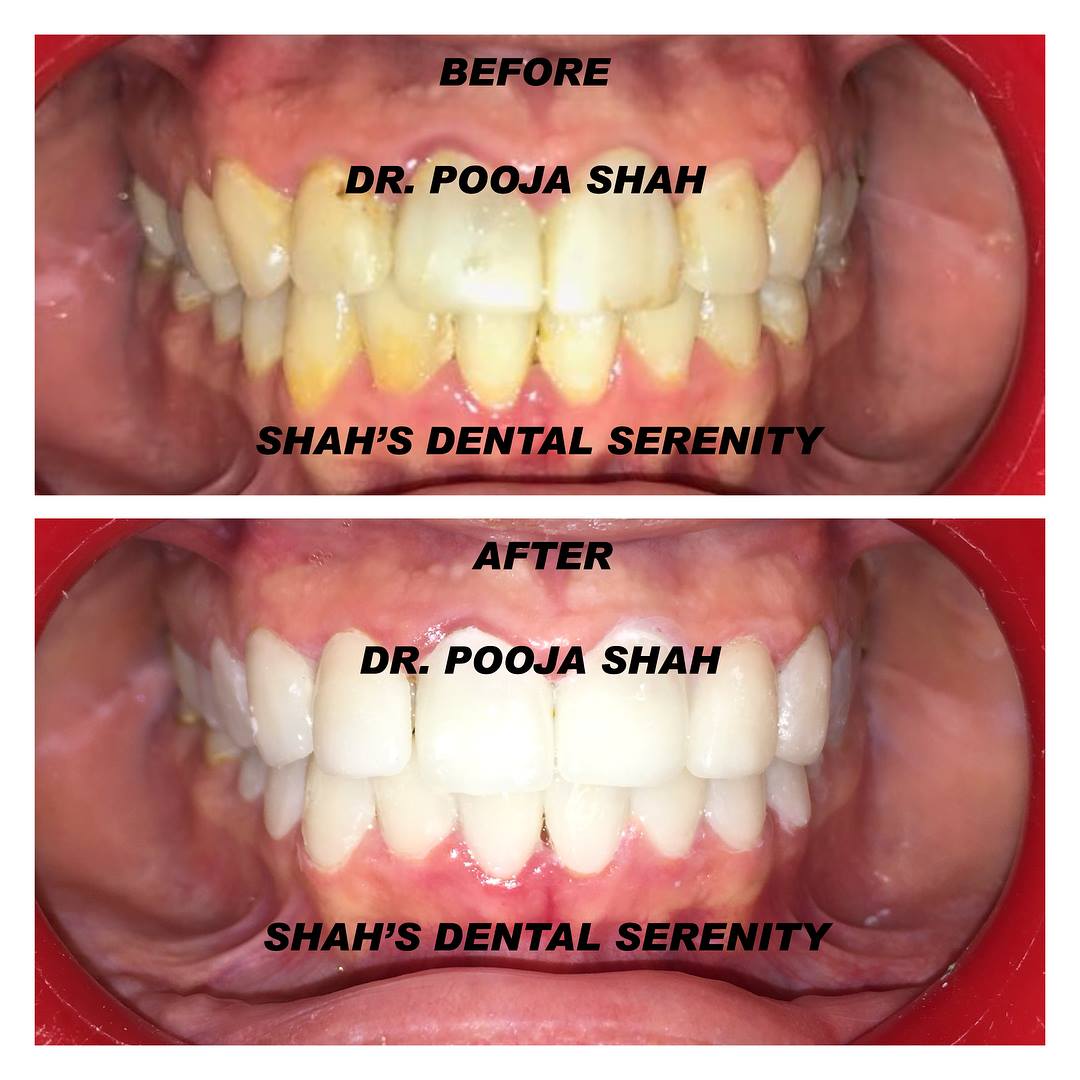 Best Dentist in Mumbai 